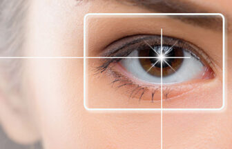 眼瞼下垂のチェック方法